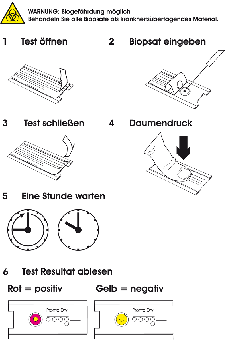 Bedienung Pronto Dry